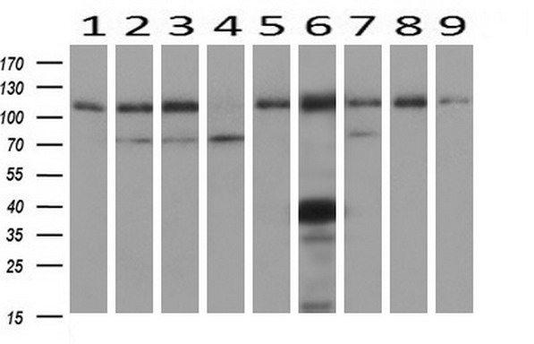 Western blot analysis of extracts (10ug) from 9 Human tissue by using anti-ADH1B monoclonal antibody at 1:1000 (1: Testis; 2: Omentum; 3: Uterus; 4: Breast; 5: Brain; 6: Liver; 7: Ovary; 8: Thyroid gland; 9: colon)