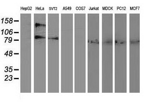 Western blot analysis of extracts (35ug) from 9 different cell lines by using anti-ADH1B monoclonal antibody