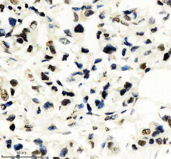 IHC analysis of RPA1 using anti-RPA1 antibody (M01317-1)