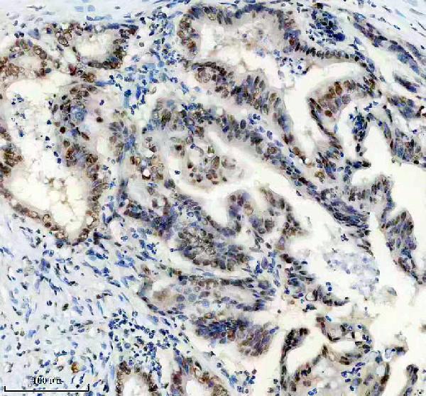 IHC analysis of RPA1 using anti-RPA1 antibody (M01317-1)