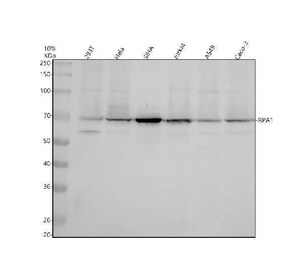 Western blot analysis of RPA1 using anti-RPA1 antibody (M01317-1)