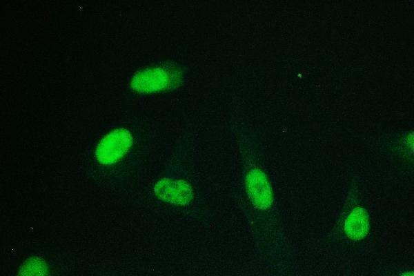m01317 2 rpa70 primary antibodies if testing 5
