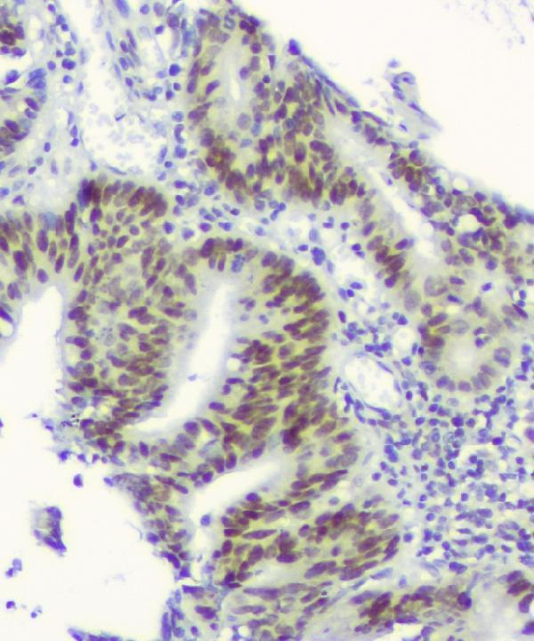 m01317 2 rpa70 primary antibodies ihc testing 2