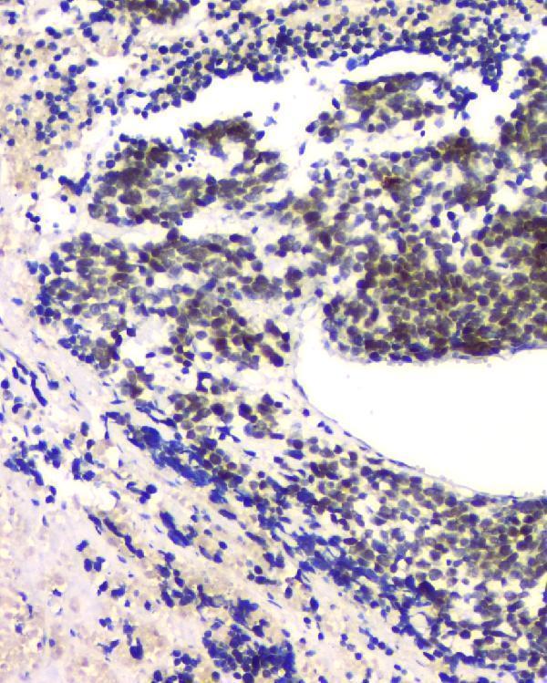 m01317 2 rpa70 primary antibodies ihc testing 3