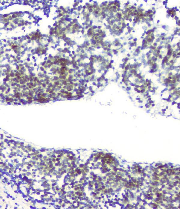 m01317 2 rpa70 primary antibodies ihc testing 4