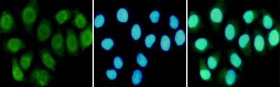 Immunocytochemistry staining of HeLa cells fixed in 1% Paraformaldehyde and using RPA1 mouse mAb (dilution 1:100)