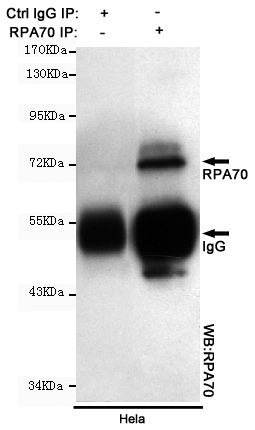 Immunoprecipitation analysis of Hela cell lysates using RPA1 mouse mAb
