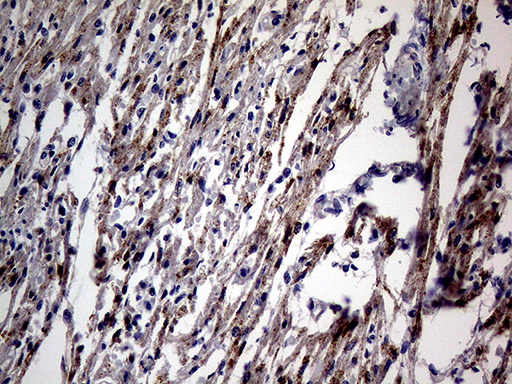 Immunohistochemical staining of paraffin-embedded Human adult heart tissue within the normal limits using anti-NPPA mouse monoclonal antibody