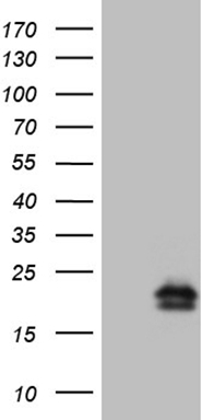 HEK293T cells were transfected with the pCMV6-ENTRY control (Left lane) or pCMV6-ENTRY NPPA (Right lane) cDNA for 48 hrs and lysed
