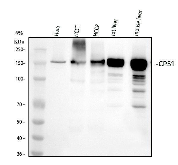  Western blot analysis of CPS1 using anti-CPS1 antibody (M01320-1)