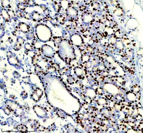 IHC analysis of TTF-1 using anti-TTF-1 antibody (M01322-3)