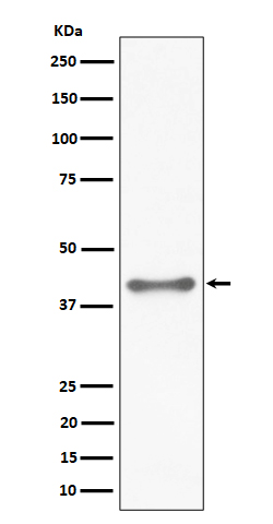 Western blot analysis of TTF1 expression in HeLa cell lysate