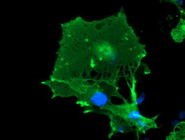 m01323 anti lim kinase 1 limk1 mouse monoclonal antibody clone id oti6b4 if testing 10
