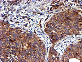 m01323 anti lim kinase 1 limk1 mouse monoclonal antibody clone id oti6b4 ihc testing 3