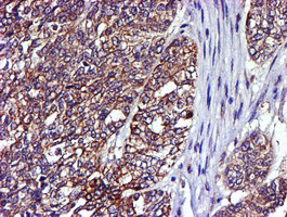 m01323 anti lim kinase 1 limk1 mouse monoclonal antibody clone id oti6b4 ihc testing 4