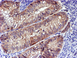 m01323 anti lim kinase 1 limk1 mouse monoclonal antibody clone id oti6b4 ihc testing 5