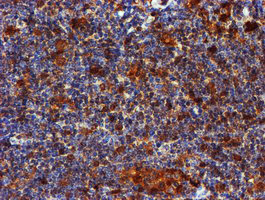 m01323 anti lim kinase 1 limk1 mouse monoclonal antibody clone id oti6b4 ihc testing 6
