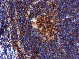 m01323 anti lim kinase 1 limk1 mouse monoclonal antibody clone id oti6b4 ihc testing 7