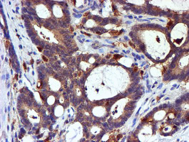 m01323 anti lim kinase 1 limk1 mouse monoclonal antibody clone id oti6b4 ihc testing 8