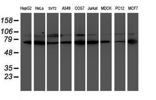 m01323 anti lim kinase 1 limk1 mouse monoclonal antibody clone id oti6b4 wb testing 2