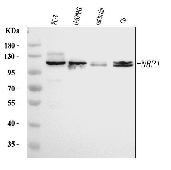  Western blot analysis of Neuropilin 1 using anti-Neuropilin 1 antibody (M01324-1)