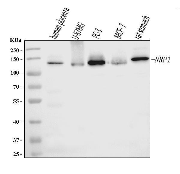  Western blot analysis of Neuropilin 1 using anti-Neuropilin 1 antibody (M01324-2)