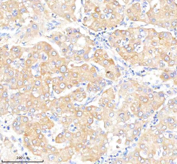 IHC analysis of NRP1 using anti-NRP1 antibody (M01324)