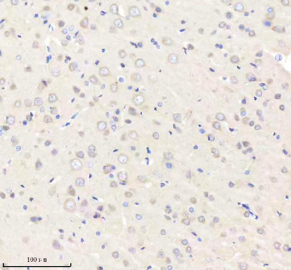 m01324 nrp1 primary antibodies ihc testing 4