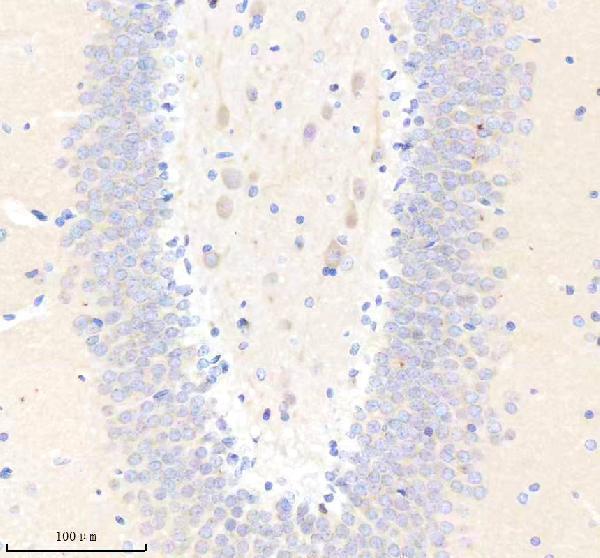 m01324 nrp1 primary antibodies ihc testing 5