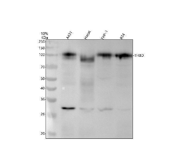 m01325 1 thbd primary antibodies wb testing 1