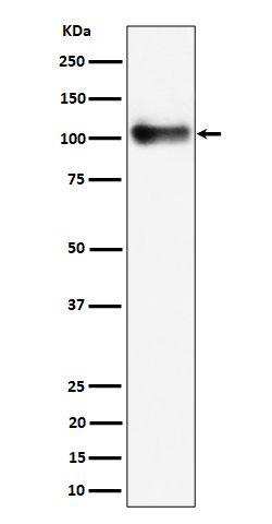 Western blot analysis of Thrombomodulin / CD141 expression in mouse lung cell lysate.
