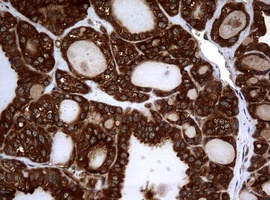 m01334 1 anti nm23a nme1 mouse monoclonal antibody clone id oti4h2 ihc testing 4