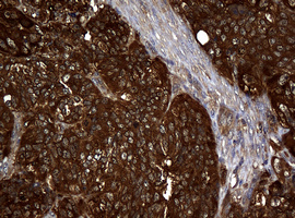 m01334 1 anti nm23a nme1 mouse monoclonal antibody clone id oti4h2 ihc testing 5