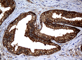 m01334 1 anti nm23a nme1 mouse monoclonal antibody clone id oti4h2 ihc testing 6