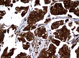m01334 1 anti nm23a nme1 mouse monoclonal antibody clone id oti4h2 ihc testing 7