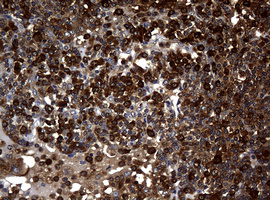 m01334 1 anti nm23a nme1 mouse monoclonal antibody clone id oti4h2 ihc testing 8