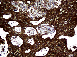 m01334 1 anti nm23a nme1 mouse monoclonal antibody clone id oti4h2 ihc testing 9