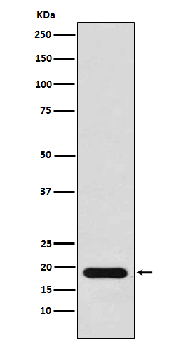 Western blot analysis of NM23 expression in MCF7 cell lysate