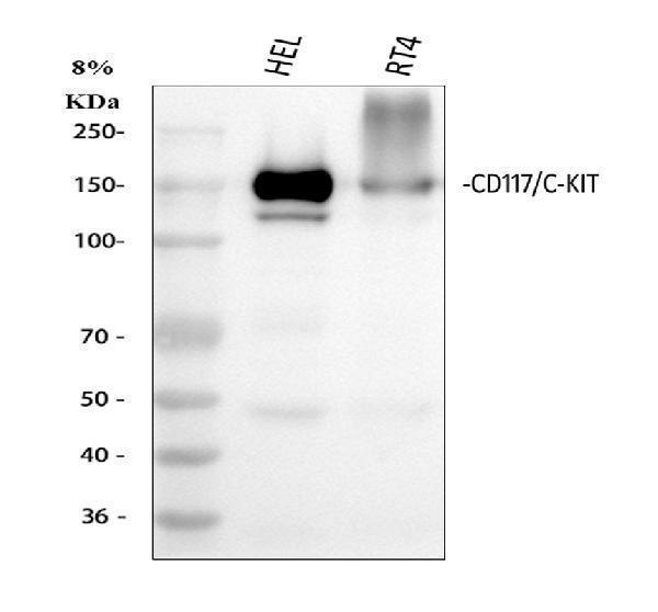  Western blot analysis of c-Kit using anti-c-Kit antibody (M01335-1)