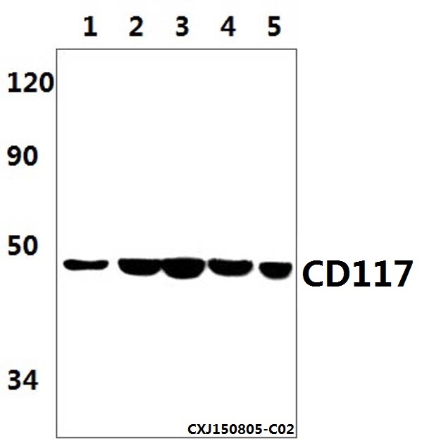 Western blot (WB) analysis of CD117 (1A9) mAb at 1:1000 dilution
Lane1:Hela whole cell lysate(40ug)
Lane2:The Testis tissue lysate of Mouse(40ug)
Lane3:The Testis tissue lysate of Rat(40ug)
Lane4:Jurkat whole cell lysate(40ug)
Lane5:HEK293T whole cell lysate(40ug)