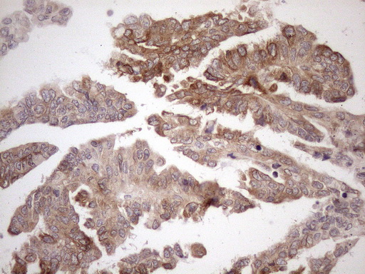m01336 anti adracalin aaas mouse monoclonal antibody clone id oti5b10 ihc testing 2