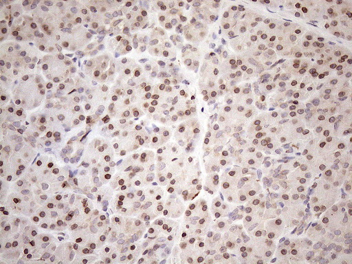 m01336 anti adracalin aaas mouse monoclonal antibody clone id oti5b10 ihc testing 3