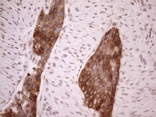m01336 anti adracalin aaas mouse monoclonal antibody clone id oti5b10 ihc testing 4
