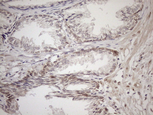m01336 anti adracalin aaas mouse monoclonal antibody clone id oti5b10 ihc testing 5