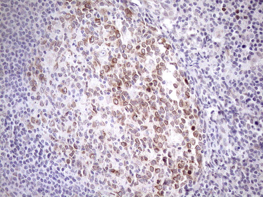 m01336 anti adracalin aaas mouse monoclonal antibody clone id oti5b10 ihc testing 6