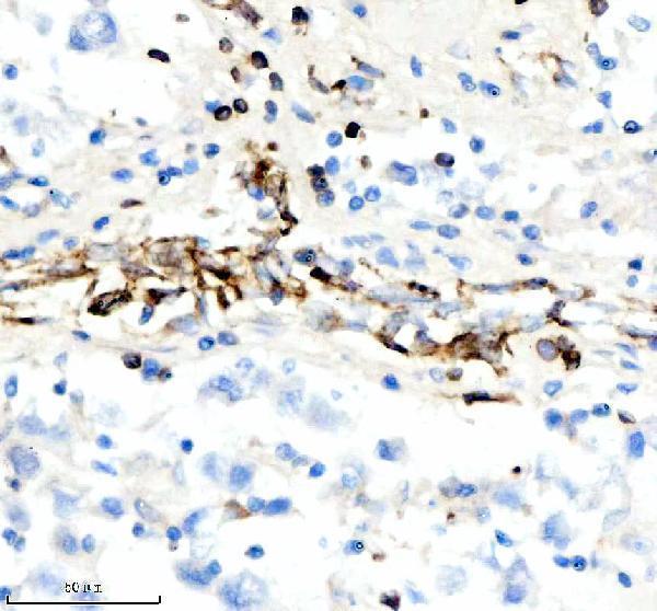 IHC analysis of CD74 using anti-CD74 antibody (M01340-2)