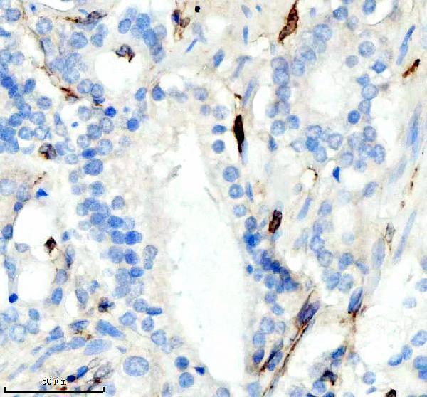 IHC analysis of CD74 using anti-CD74 antibody (M01340-2)