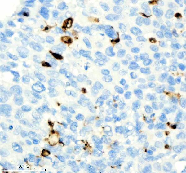 m01340 2 cd74 primary antibodies ihc testing 3_1