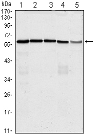 Western blotting validation for Anti-M-phase inducer phosphatase 3 CDC25C Monoclonal Antibody M01343-1
Western Blot (WB) analysis using CDC25C Monoclonal Antibody against HeLa (1)