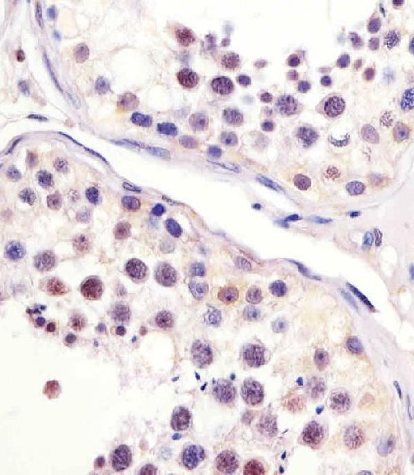 M01343-2 staining MPIP3 in human testis sections by Immunohistochemistry (IHC-P -paraformaldehyde-fixed, paraffin-embedded sections)